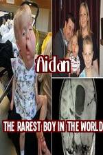 Watch Aidan The Rarest Boy In The World Zmovie