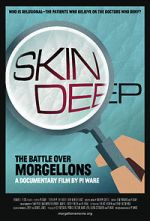 Watch Skin Deep: The Battle Over Morgellons Zmovie