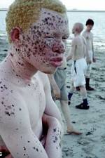 Watch Albino United Zmovie