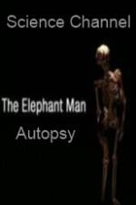 Watch Science Channel Elephant Man Autopsy Zmovie