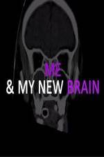 Watch Me & My New Brain Zmovie