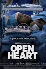 Watch Open Heart Zmovie