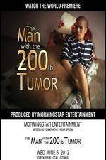 Watch The Man With The 200lb Tumor Zmovie