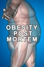 Watch Obesity: The Post Mortem Zmovie