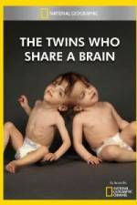 Watch National Geographic The Twins Who Share A Brain Zmovie