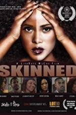 Watch Skinned Zmovie