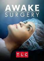 Watch Awake Surgery Zmovie