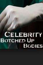 Watch Celebrity Botched Up Bodies Zmovie